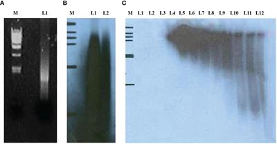 A tumor-associated autoantibody panel for the detection of non-small cell lung cancer